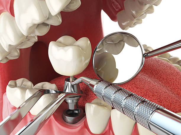 Best Emergency Dental Services for Seniors in Conway, SC